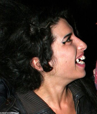 amy-tooth.jpg